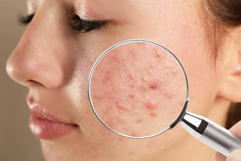 The Truth About Scar Gel 7 Myths You Should Stop Believing